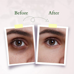 Lotus Organics+ Cosmetics Precious Brightening Under Eye Cream 15ml Lotus Organics+ Cosmetics Precious Brightening Under Eye Cream 15ml