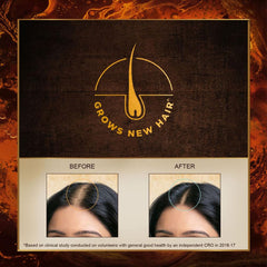 Indulekha Svetakutaja 100% Ayurvedic Medicinal Hair Oil For Dandruff Treatment Oil Indulekha Svetakutaja 100% Ayurvedic Medicinal Hair Oil For Dandruff Treatment Oil