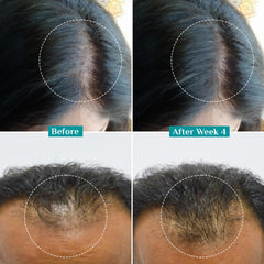 Pilgrim Cosmetics 3% Redensyl & 4% Anagain Advanced Hair Growth Serum 30ml Pilgrim Cosmetics 3% Redensyl & 4% Anagain Advanced Hair Growth Serum 30ml