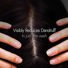 Kapiva Dandruff Control Neem Triphaladi Shampoo 250ml Kapiva Dandruff Control Neem Triphaladi Shampoo 250ml