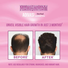Mahishmati Adivasi Herbal Shampoo 100ml Mahishmati Adivasi Herbal Shampoo 100ml