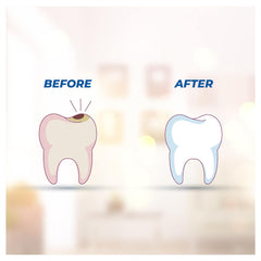 Smyle Herbal Teeth Toothpaste 100gm Smyle Herbal Teeth Toothpaste 100gm