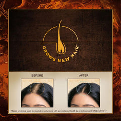 Indulekha Bringha Hair Oil Selfie Bottle 100ml Indulekha Bringha Hair Oil Selfie Bottle 100ml