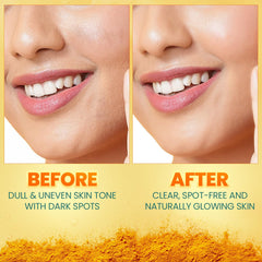 Himalaya Dark Spot Clearing Turmeric Face Serum Himalaya Dark Spot Clearing Turmeric Face Serum