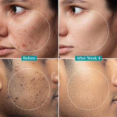 Pilgrim Cosmetics 2% Alpha Arbutin Brightening Serum 30ml Pilgrim Cosmetics 2% Alpha Arbutin Brightening Serum 30ml