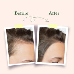 Lotus Organics+ Cosmetics Hair Fall Control Shampoo 300ml Lotus Organics+ Cosmetics Hair Fall Control Shampoo 300ml