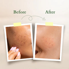 Lotus Organics+ Vit C Glow Face Oil 15ml Lotus Organics+ Vit C Glow Face Oil 15ml