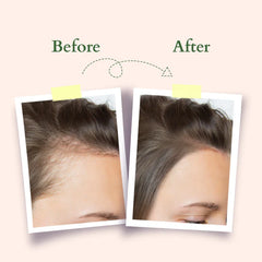 Lotus Organics+ Cosmetics Hair Fall Control Multi Herbs Oil 200ml Lotus Organics+ Cosmetics Hair Fall Control Multi Herbs Oil 200ml