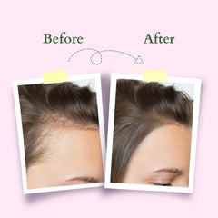 Lotus Organics+ Cosmetics Hair Growth Active Concentrate Serum 28ml Lotus Organics+ Cosmetics Hair Growth Active Concentrate Serum 28ml