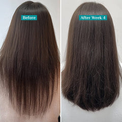 Pilgrim Cosmetics Redensyl & Anagain Hairfall Control Hair Shampoo 200 ml 6.8 fl. oz Pilgrim Cosmetics Redensyl & Anagain Hairfall Control Hair Shampoo 200 ml 6.8 fl. oz