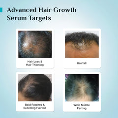 Pilgrim Cosmetics 3% Redensyl & 4% Anagain Advanced Hair Growth Serum 30ml Pilgrim Cosmetics 3% Redensyl & 4% Anagain Advanced Hair Growth Serum 30ml
