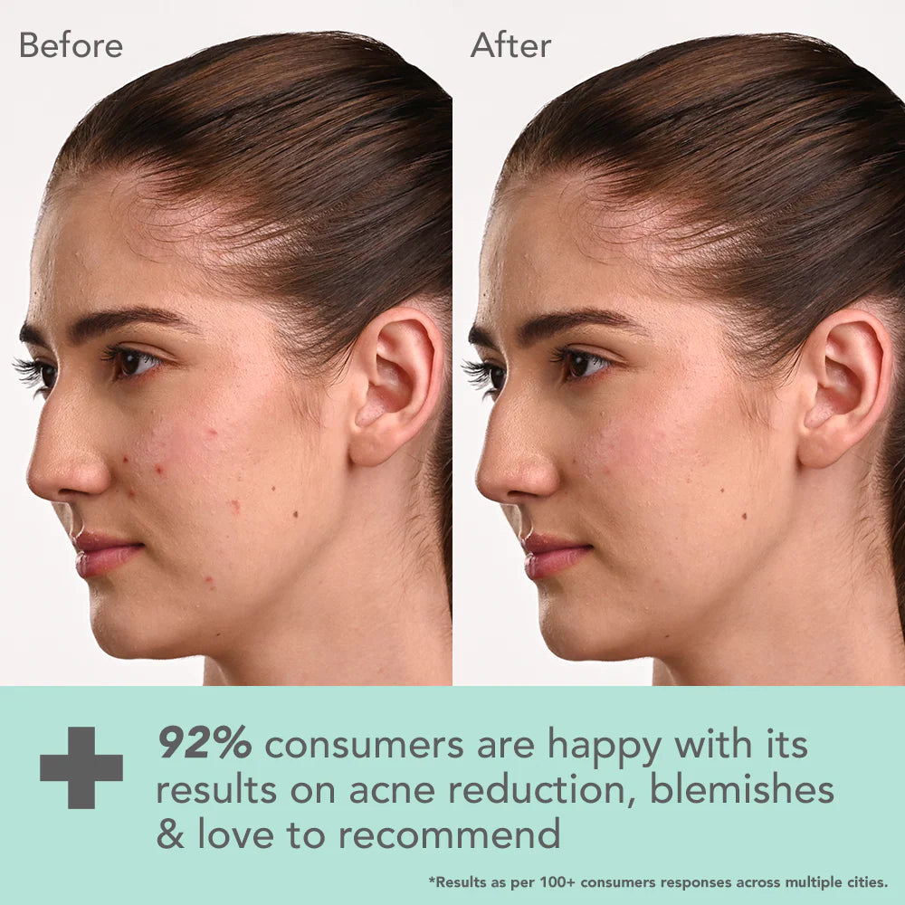 Lotus Cosmetics Derma Botanics Kojic Acid + Multi Berry Blemish Free Facewash 100g