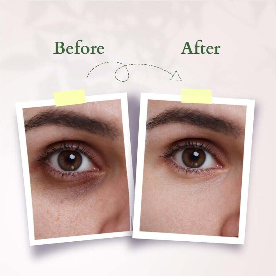 Lotus Organics+ Cosmetics Precious Brightening Under Eye Cream 15ml