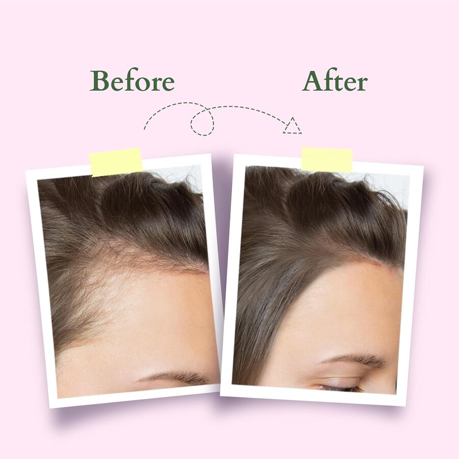 Lotus Organics+ Cosmetics Hair Growth Active Concentrate Serum 28ml