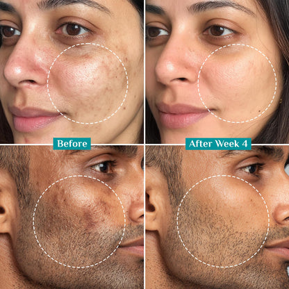 Pilgrim Cosmetics 15% Vitamin C Face Serum For Advanced Brightness 20ml