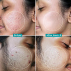 Pilgrim Cosmetics 2% Salicylic Acid Anti-Acne Face Serum 30ml