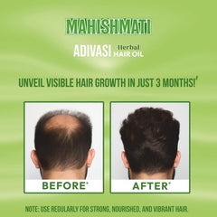Mahishmati Ayurvedic Adivasi Herbal Hair Growth Oil,Controls Hair Fall,Strong Hair Oil 100ml