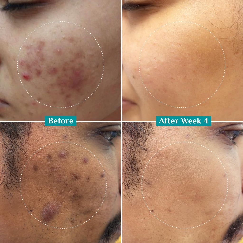 Pilgrim Cosmetics 10% Niacinamide Face Serum With 1% Zinc PCA 30ml