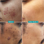 Pilgrim Cosmetics 10% Niacinamide Face Serum With 1% Zinc PCA 30ml