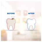 Smyle Kräuterzahnpasta 100g