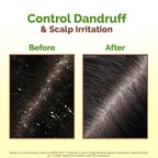 Mamaearth Lemon Anti-Dandruff Hair Oil with Lemon & Ginger 100ml