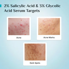 Pilgrim Cosmetics 2% Salicylic Acid Anti-Acne Face Serum 30ml