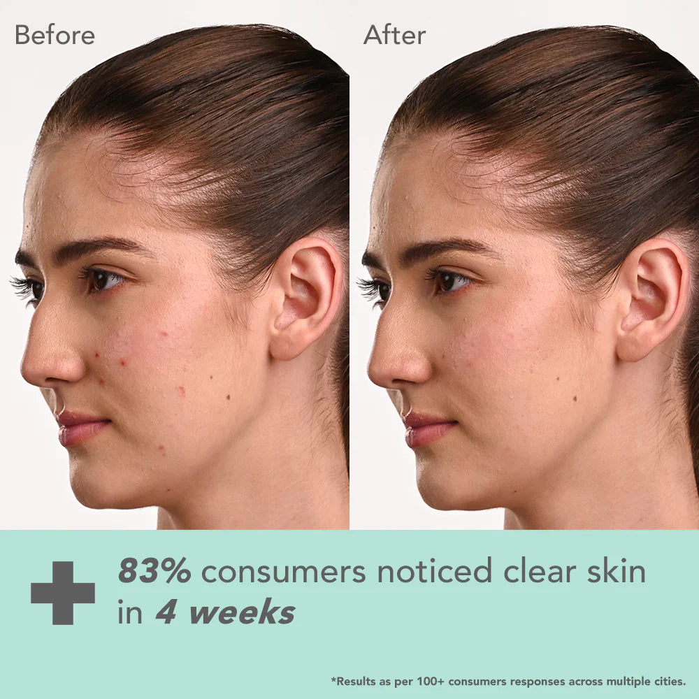 Lotus Cosmetics Derma Botanics Kojic Acid + Multi Berry Ampoule Crème Cream 50g