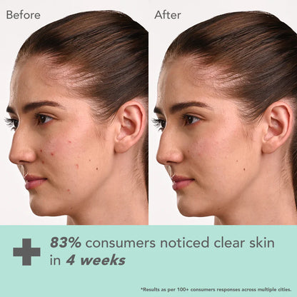 Lotus Cosmetics Derma Botanics Kojic Acid + Multi Berry Ampoule Crème Cream 50g