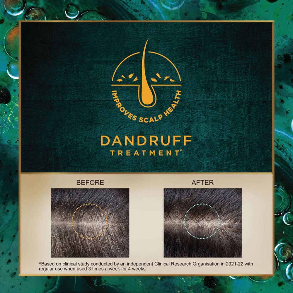 Indulekha Svetakutaja 100 % ayurvedisches medizinisches Haaröl zur Behandlung von Schuppen