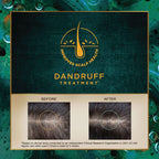 Indulekha Svetakutaja 100 % ayurvedisches medizinisches Haaröl zur Behandlung von Schuppen