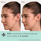 Lotus Cosmetics Derma Botanics Kojic Acid + Multi Berry Serum 28ml