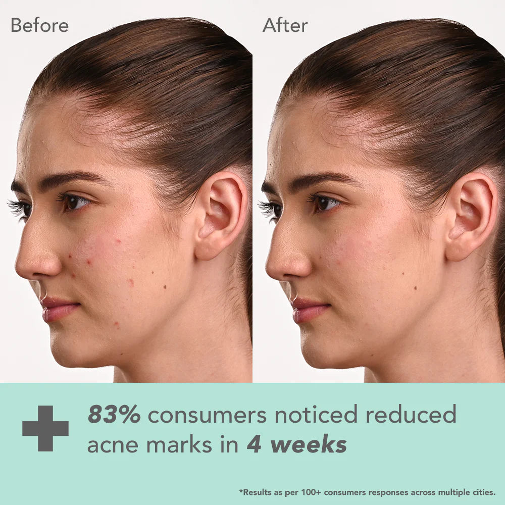 Lotus Cosmetics Derma Botanics Kojic Acid + Multi Berry Serum 28ml