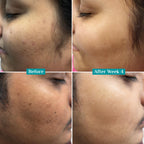 Pilgrim Cosmetics 10% Vitamin C Face Serum 30ml